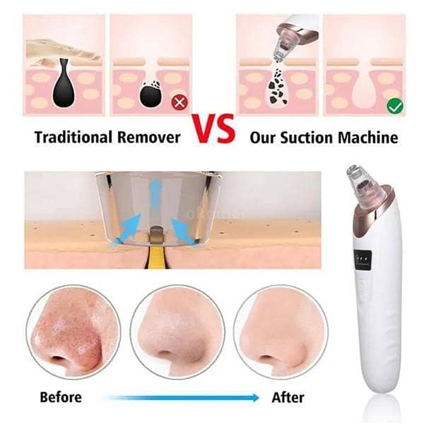 Blackhead Removing Tool 1