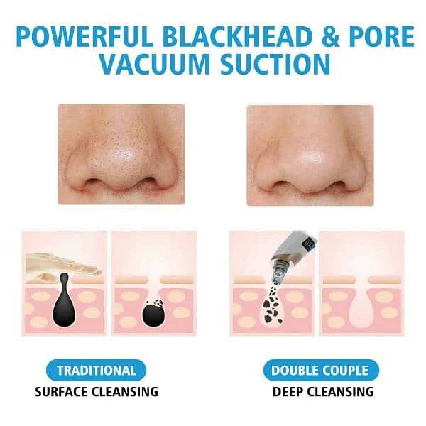 portable blackhead Pore Cleaner 1