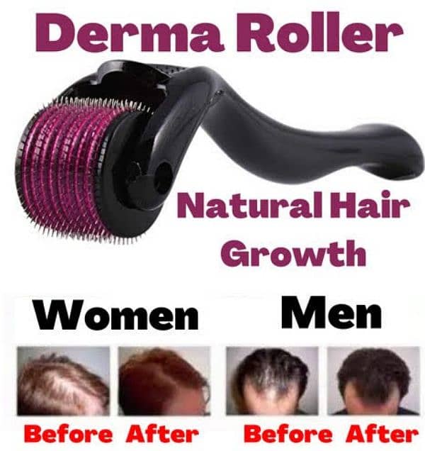 derma roller 0.5 mm 3