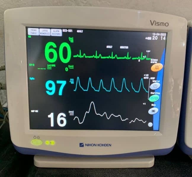 Cautery Machines - Defibrillator - Nihon kohden Patient monitor 11