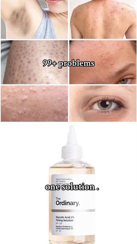 The Ordinary Glycolic Acid 7% Toning Solution 240 ml 1