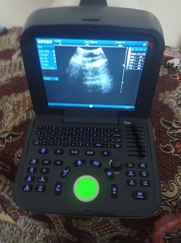 ultrasound chemistry hematology Analyser ECG usg printer mindray oriel 1