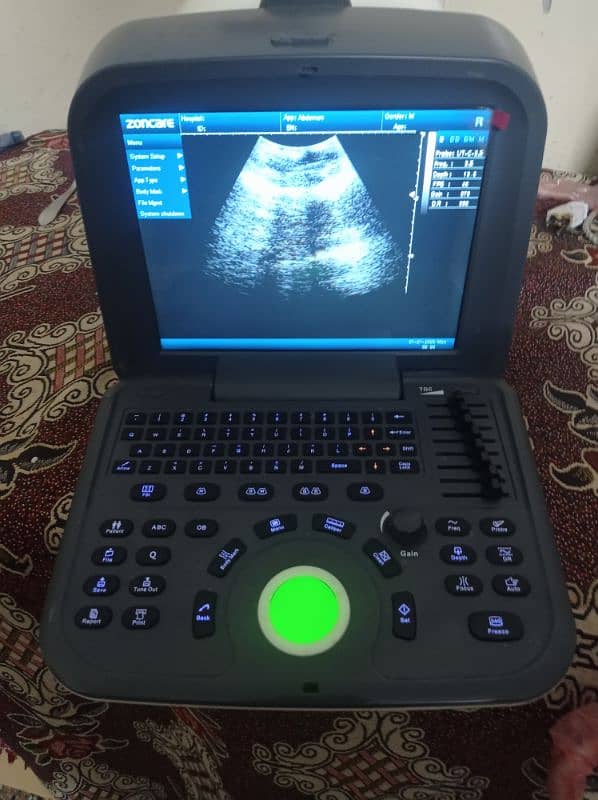 ultrasound chemistry hematology Analyser ECG usg printer mindray oriel 2