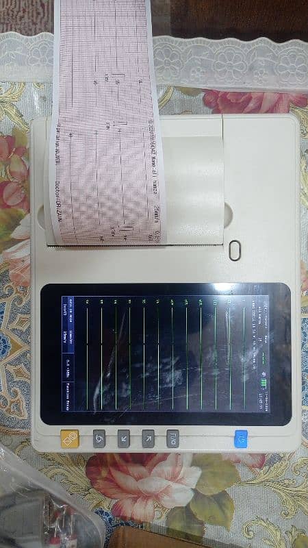 ultrasound chemistry hematology Analyser ECG usg printer mindray oriel 3