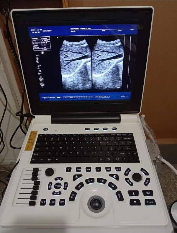 ultrasound chemistry hematology Analyser ECG usg printer mindray oriel 10