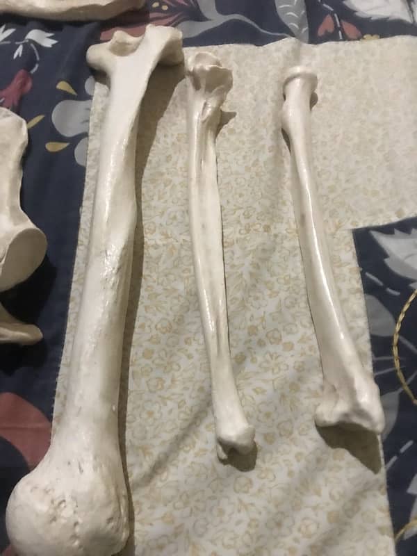 anatomy upper and lower limb bones 7