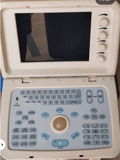 ultrasound machine for rent with sony printer all ok in working