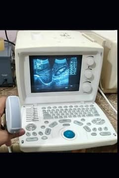 ultrasound machine