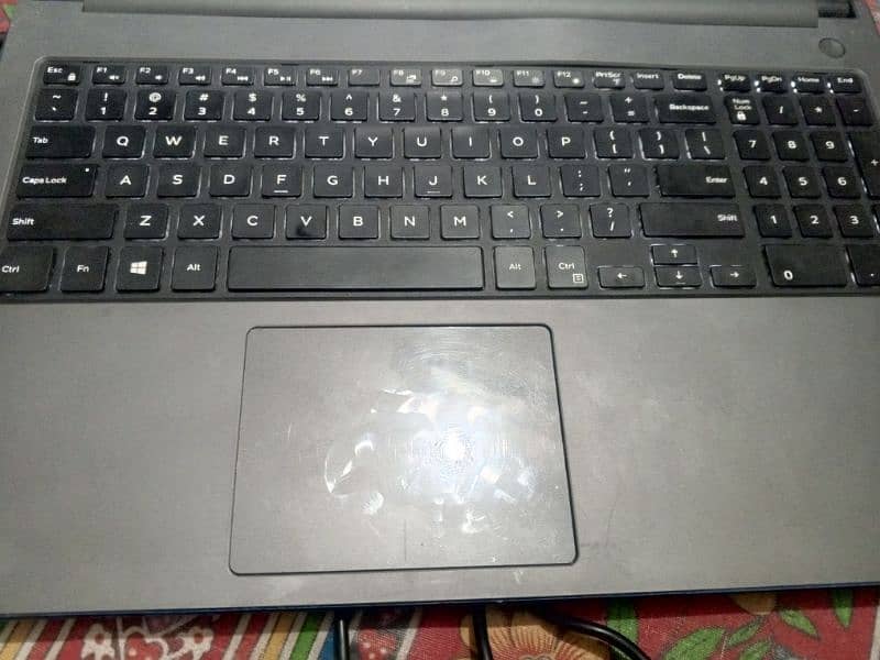 Dell Inspiration 5559 (Touch Screen) 3