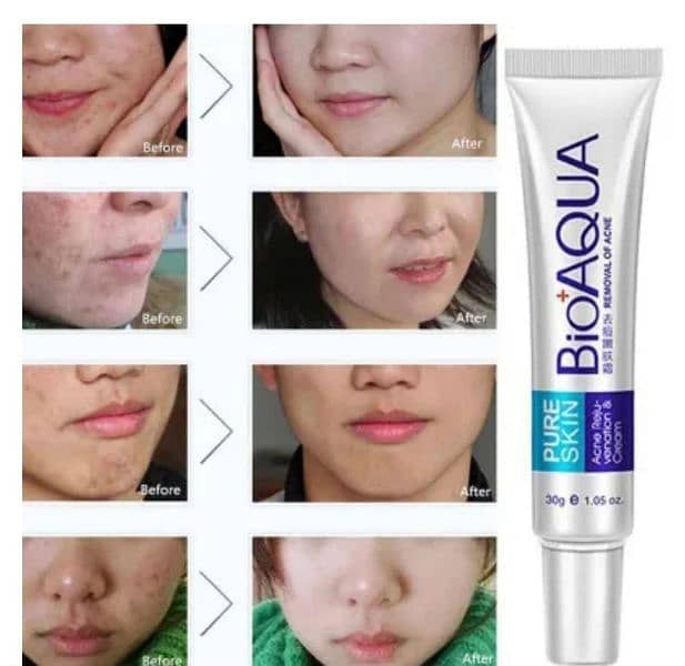 Premium Acne Scar Removal Cream Contact:03290570110 2