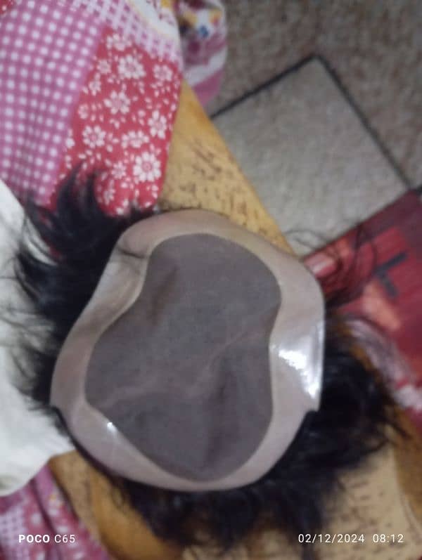 Hair patch In best price 1