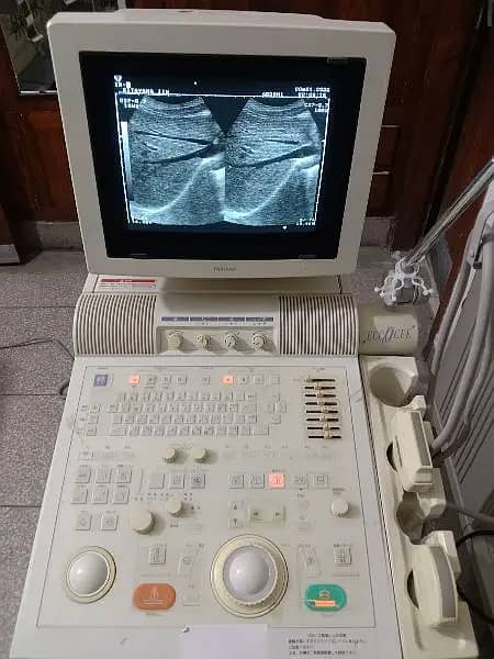 ultrasound machine / Xario 100 /  japanese ultrasound machines 7