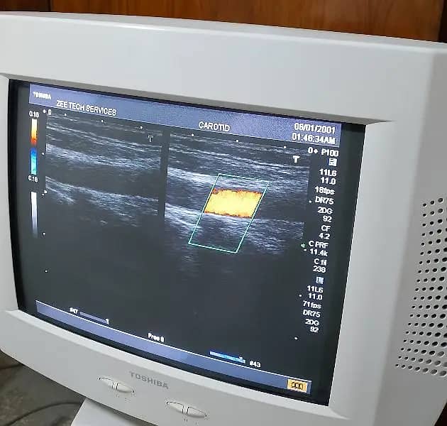 ultrasound machine / Xario 100 /  japanese ultrasound machines 8