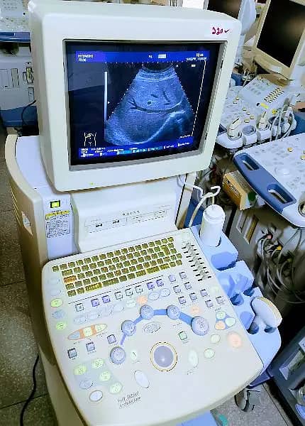 ultrasound machine / Xario 100 /  japanese ultrasound machines 10