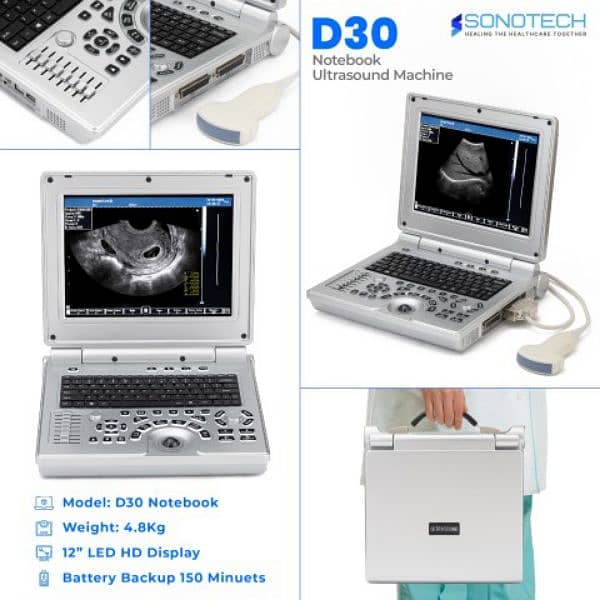 Brand New Best ever japanese standard D30 notebook ultrasound machine 1