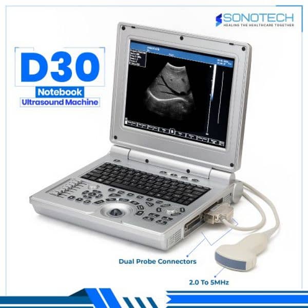 Brand New Best ever japanese standard D30 notebook ultrasound machine 2