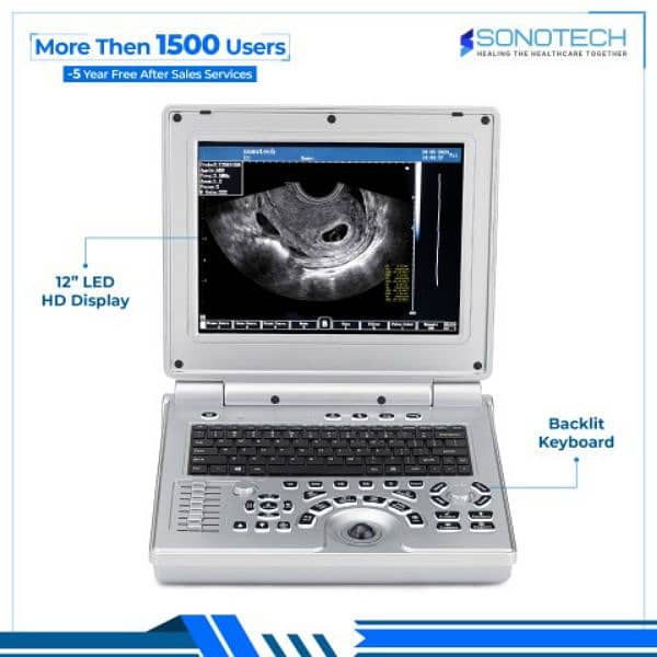 Brand New Best ever japanese standard D30 notebook ultrasound machine 3