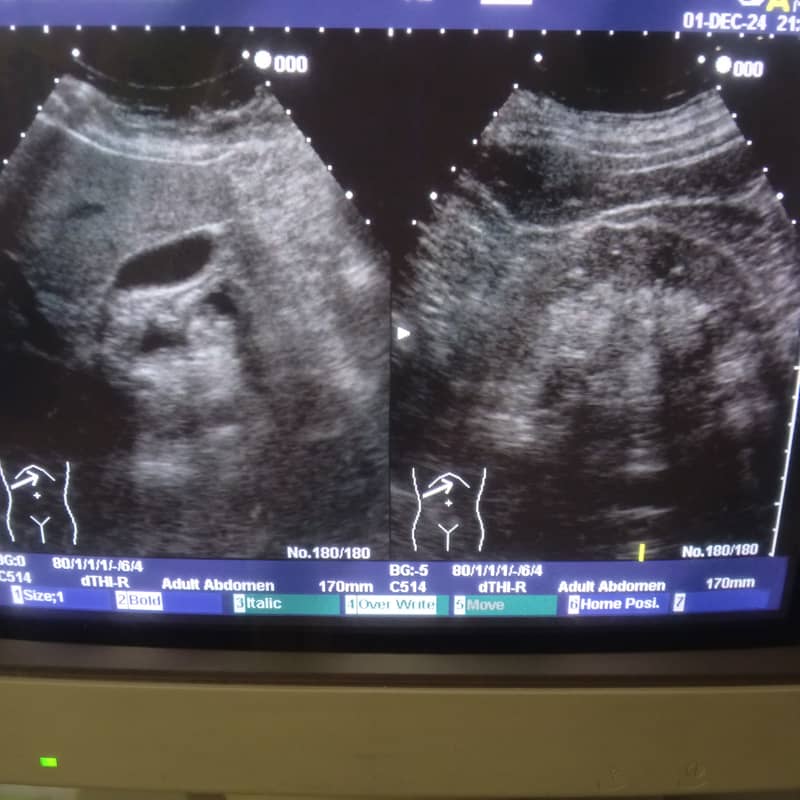 Lady doctor with ultrasound experience required 2