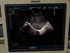 Philips HD9 Color Doppler