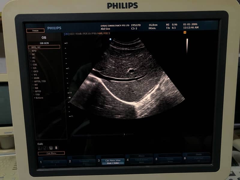 Philips HD9 Color Doppler 0