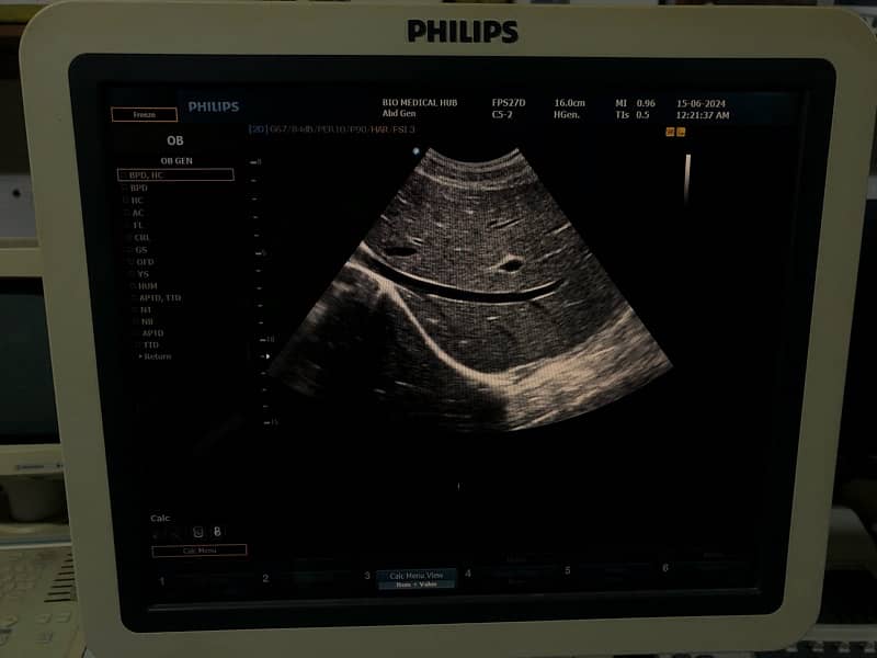 Philips HD9 Color Doppler 4