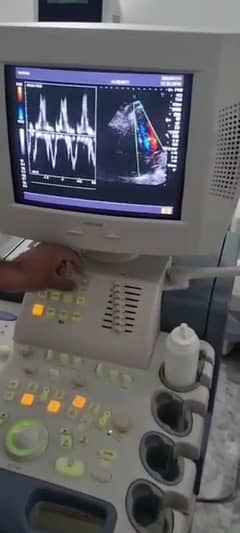 Nemia 35 Ultrasound Machine