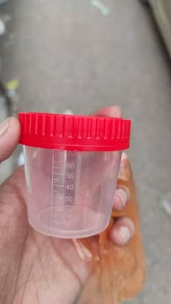 Urine Container