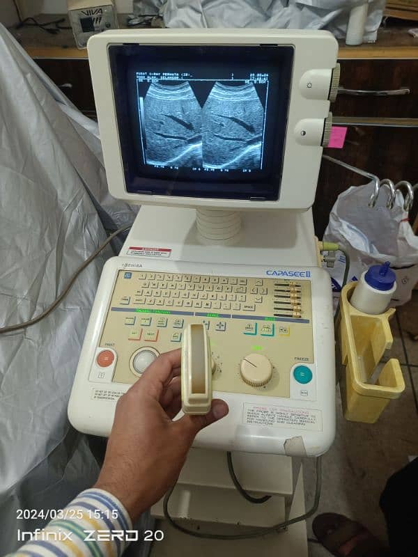 Japanese & china Ultrasound Machine's 12