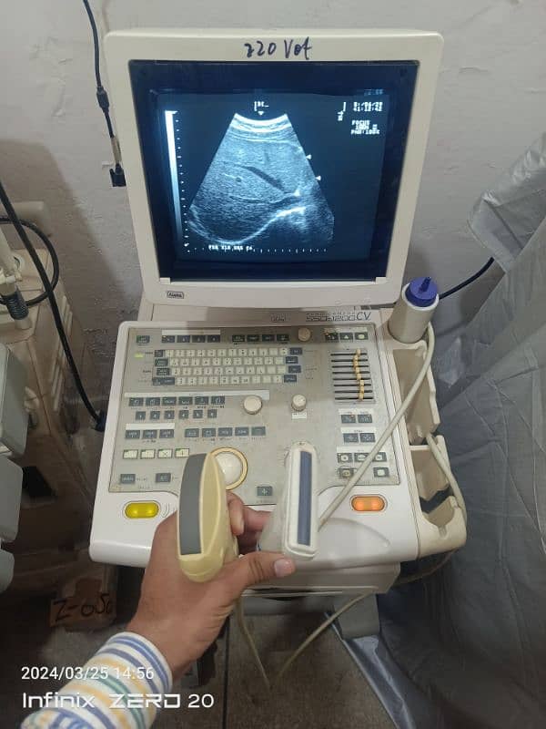 Japanese & china Ultrasound Machine's 13