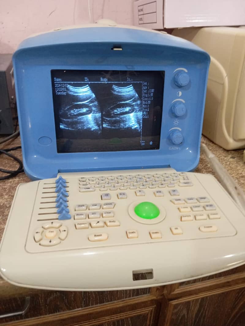 Used Chinese Ultrasound Machine (with or without BATTERY BACK UP) 1