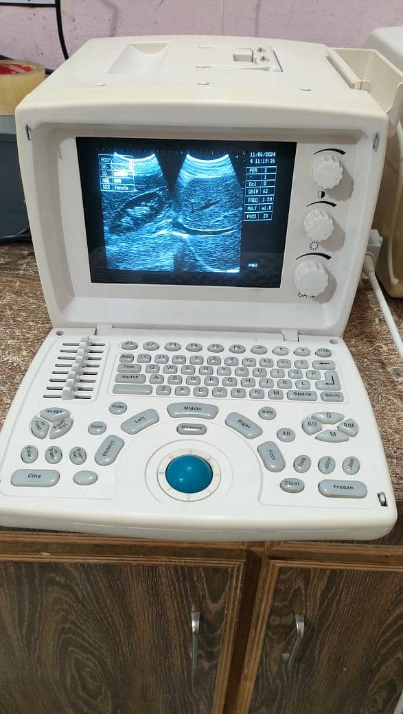 Used Chinese Ultrasound Machine (with or without BATTERY BACK UP) 3