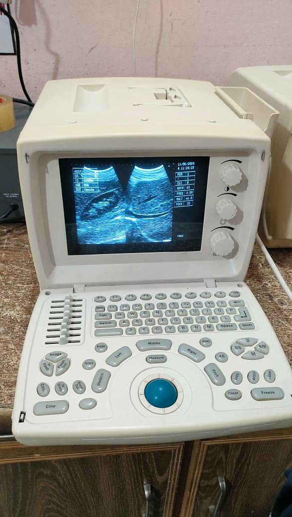 Used Chinese Ultrasound Machine (with or without BATTERY BACK UP) 5