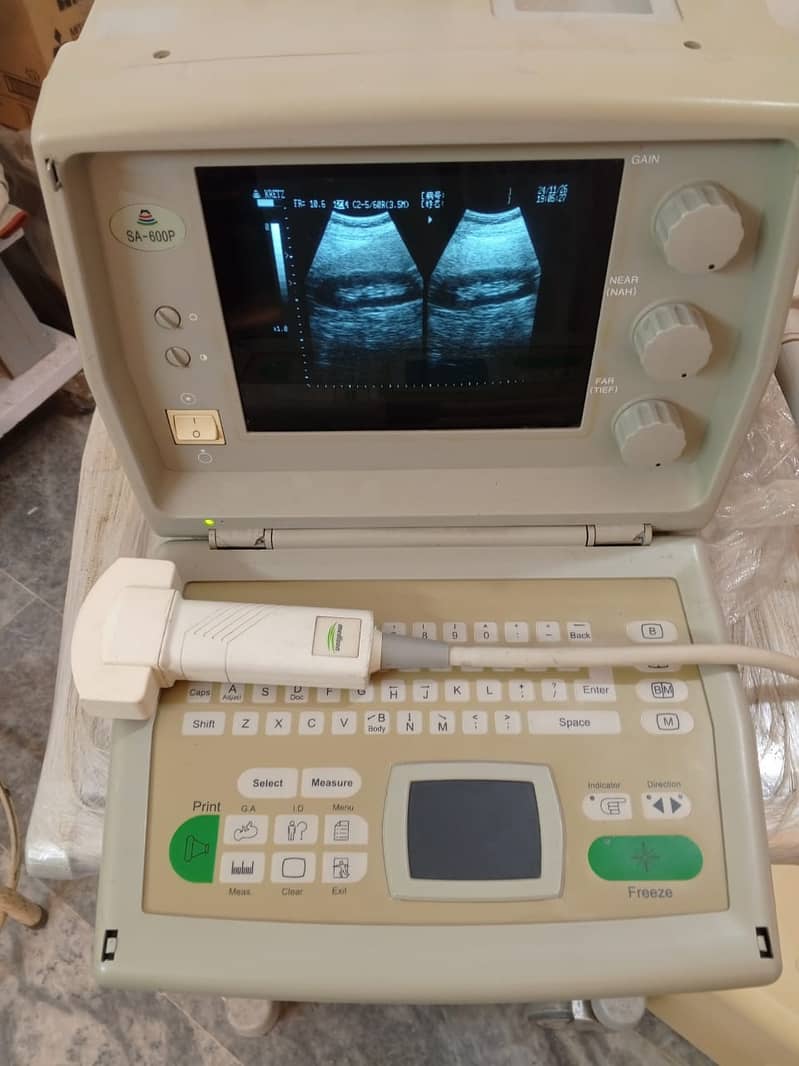 Brand New  ultrasound machine / ny10 ultrasound machine 3