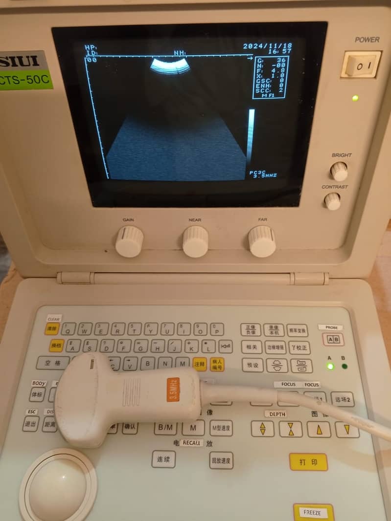 Brand New  ultrasound machine / ny10 ultrasound machine 12