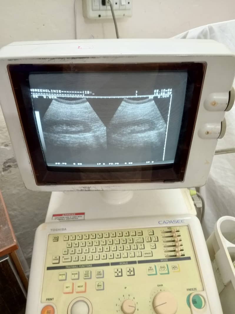 Brand New  ultrasound machine / ny10 ultrasound machine 13