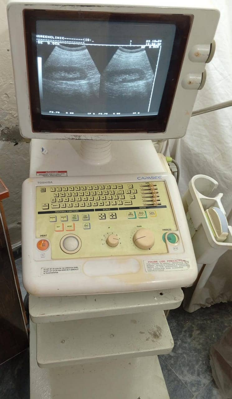 Brand New  ultrasound machine / ny10 ultrasound machine 14