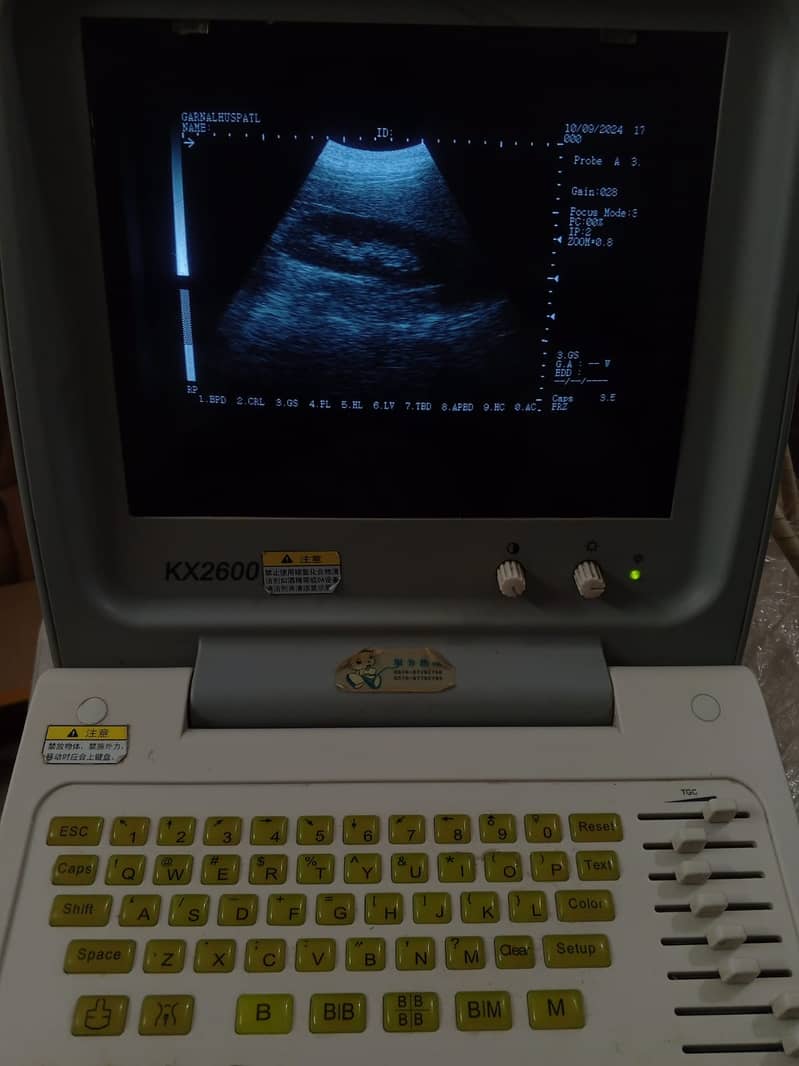 Brand New  ultrasound machine / ny10 ultrasound machine 19