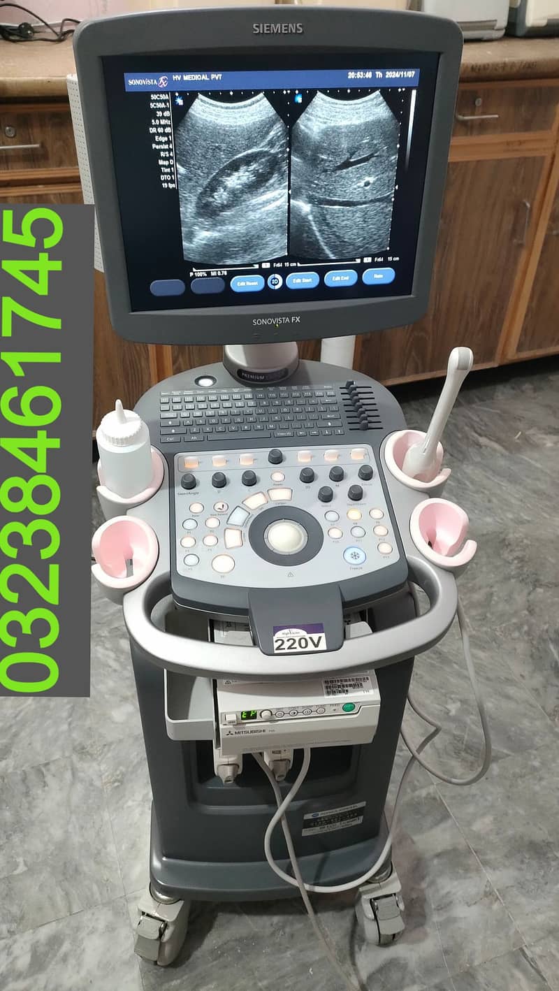 siemions fx(2016 year wali) japanese colour doppler ultrasound machine 0