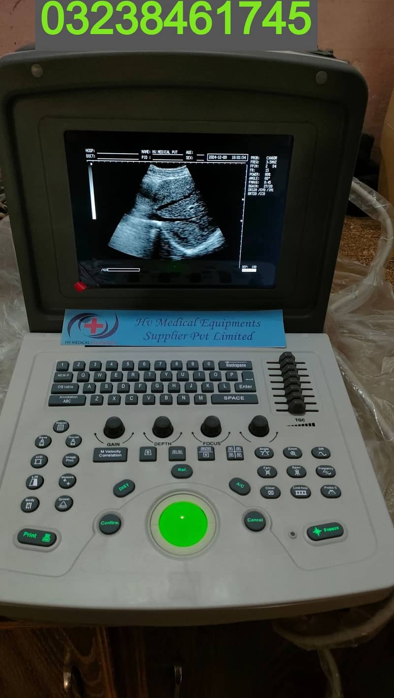 brand new china volta 100 ultrasound machine with battery backup 0