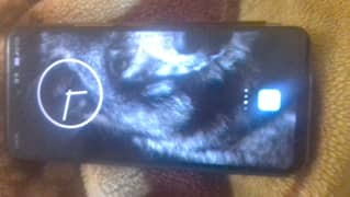 Tecno Camon 18P