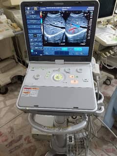 poartable ultrasound