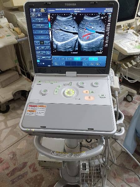 poartable ultrasound 0