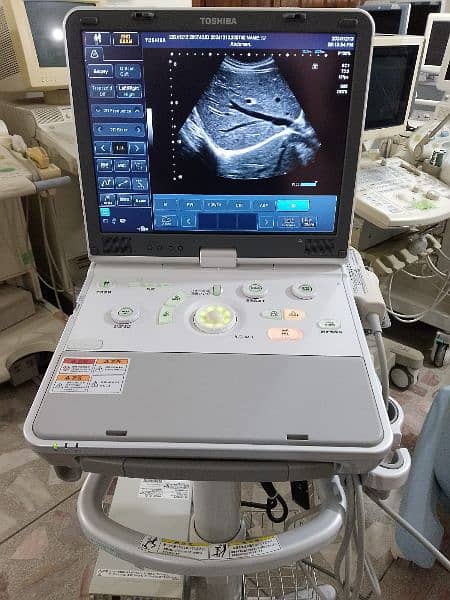 poartable ultrasound 1