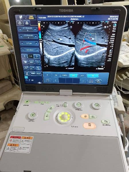 poartable ultrasound 2