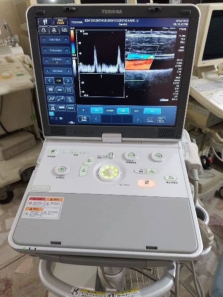 poartable ultrasound 3