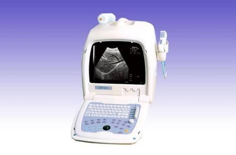 Ultrasound Machine EMP-860 portable 0