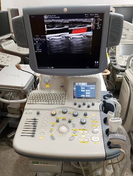 ultrasound machine logiq s6 3