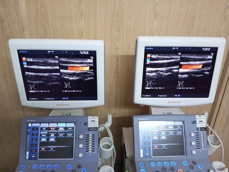 ultrasound machine Aloka alpha6 2