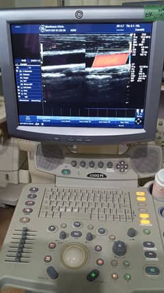 Ultrasound grey scale and colour Doppler