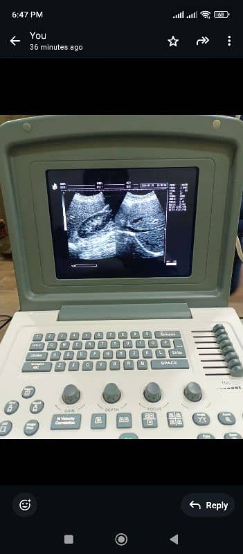 portable ultrasound machine 1